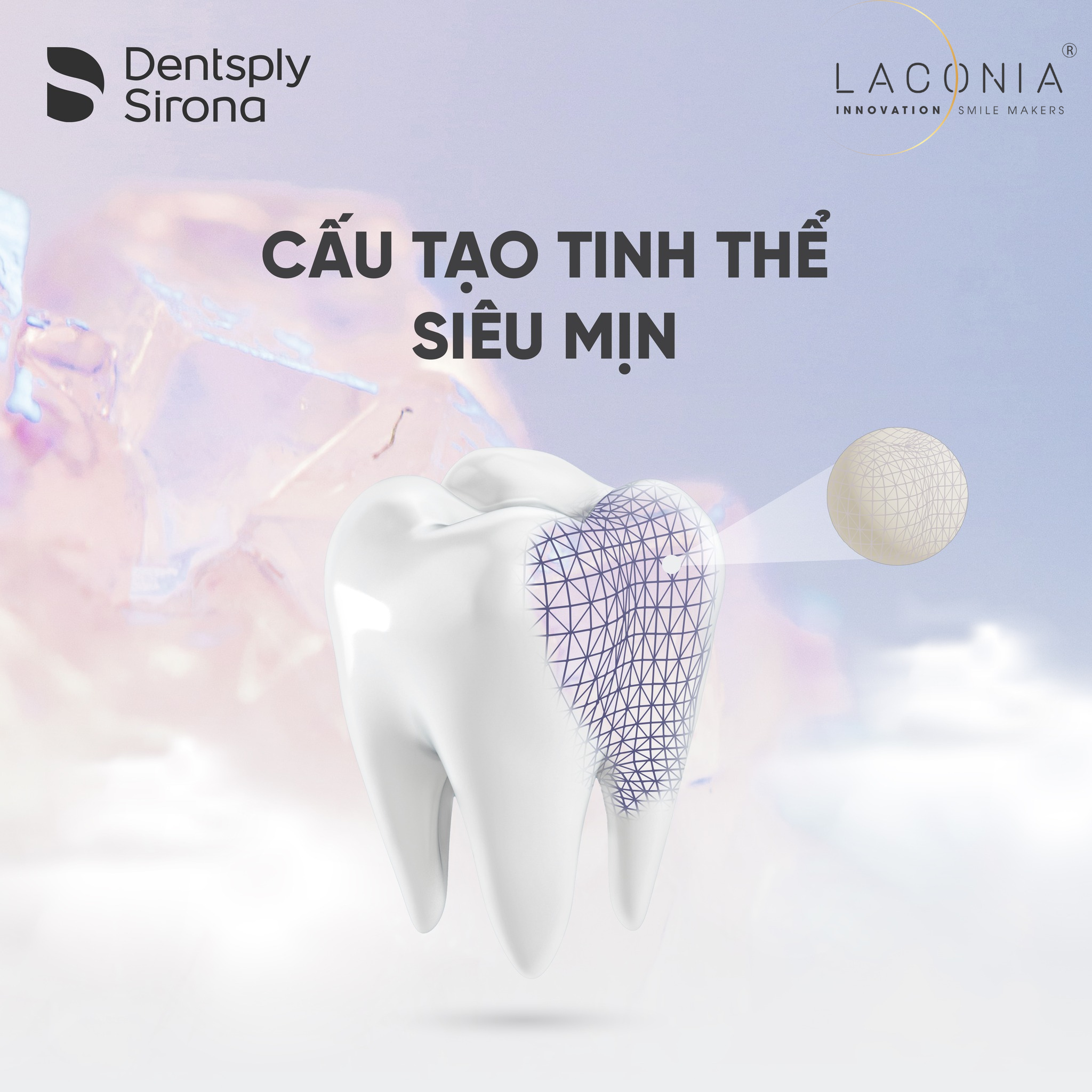 Răng sứ Laconia ngăn ngừa hiện tượng vi kẽ tối đa